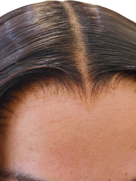 Skinlike HD Closure